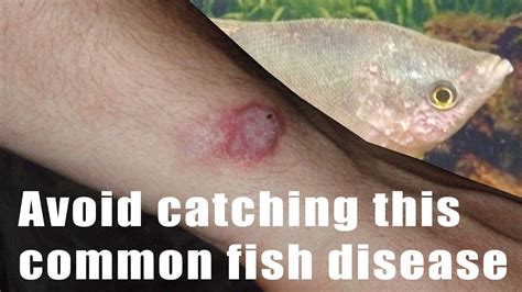 How To Identify And Avoid Catching Fish Tb Tuberculosis Mycobacterium