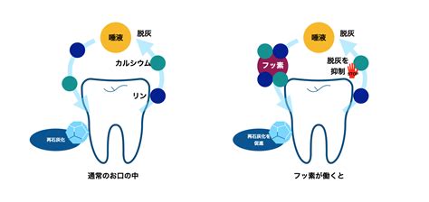 むし歯予防の強い味方！フッ化物（フッ素）の効果とは？ 新浦安の歯医者・歯科｜栗林歯科医院｜各専門医在籍