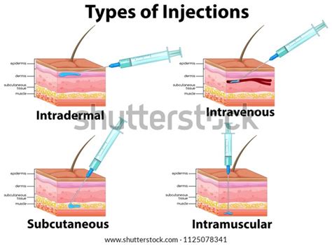 Set Type Injections Illustration Stock Vector Royalty Free