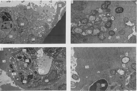 Figure 2 From Uptake Of Killed Yersinia Enterocolitica By Pseudopodia