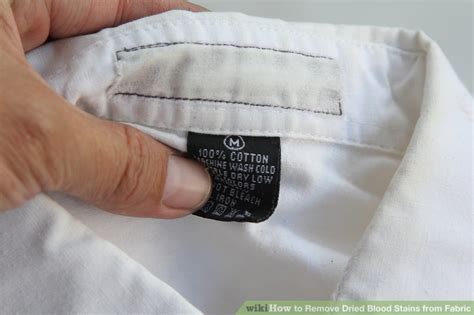 5 Ways to Remove Dried Blood Stains from Fabric - wikiHow