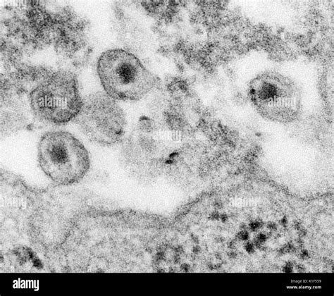 Transmission Electron Micrograph Human Hi Res Stock Photography And