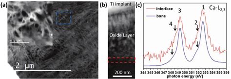 ELNES comparison of Ca-L 2,3 from bone and interface. HAADF-STEM images ...