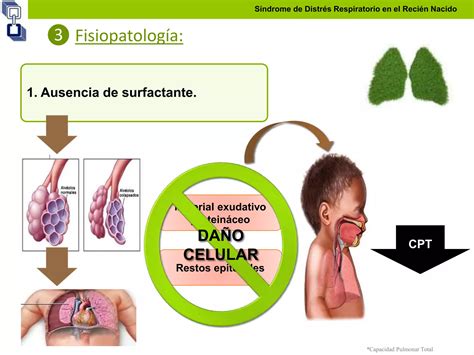 Síndrome de Distrés Respiratorio en el RN PPT