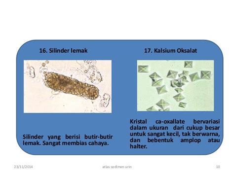 Isi Atlas Sedimen Urin