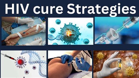 Hiv Cure Research Strategies With Good Prospect And Drug Development