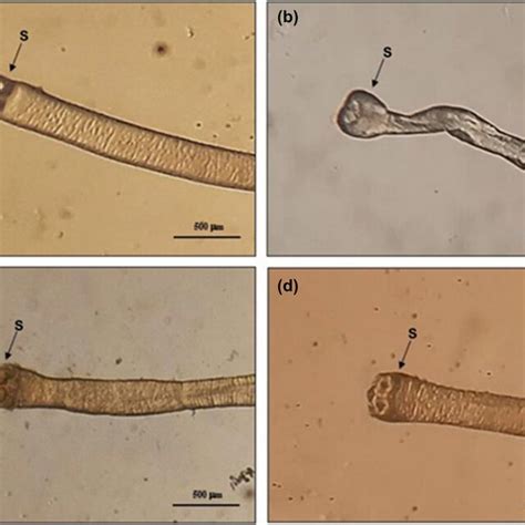 Stereo Micrographs Of Unstained H Diminuta A Control Showing