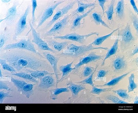 Cells Mitosis Microscope Hi Res Stock Photography And Images Alamy