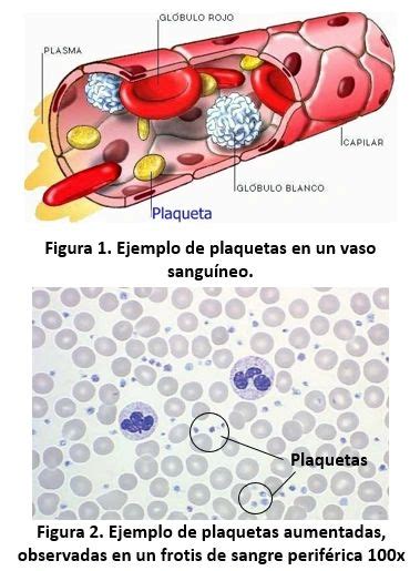 Salida Hacia Autoridad Xtasis Que Son Las Plaquetas Altas En La Sangre