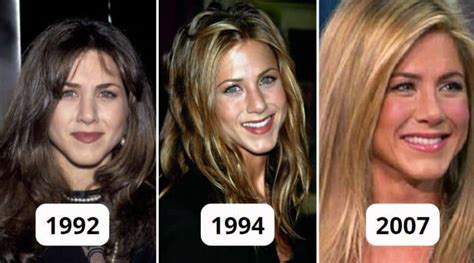 Les Secrets Des Chirurgies Esth Tiques De Jennifer Aniston