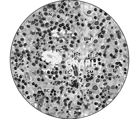 Spleen Histology X540 Labeled Zoom