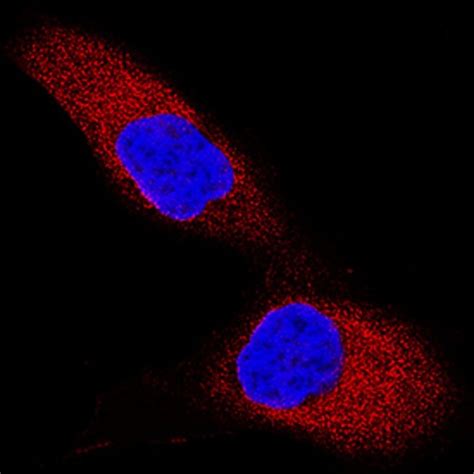 Humanmouserat Traf 2 Antibody R D Systems 100ug Unlabeled