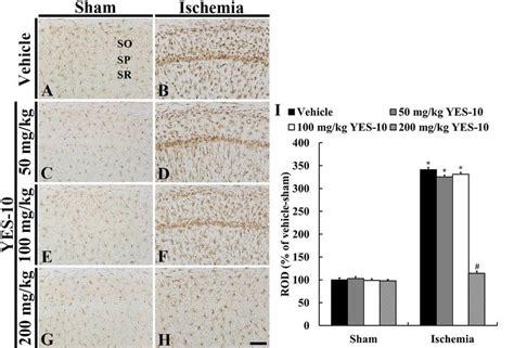 Immunohistochemistry For Iba In The Hippocampal Ca Field Of The