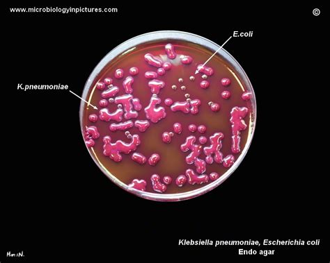 Colony Morphology Of Klebsiella Pneumoniae