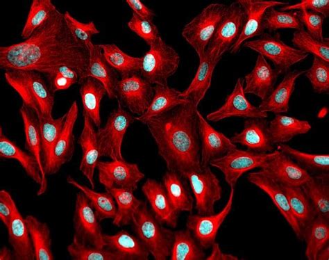 anti-mouse Secondary Antibodies