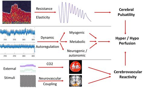 Stroke Aha Asa On Twitter Stroke Focused Update Bloodpressure New