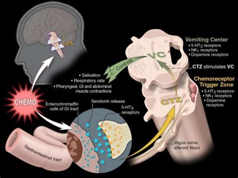 Cinv Chemotherapy Induced Nausea And Vomiting