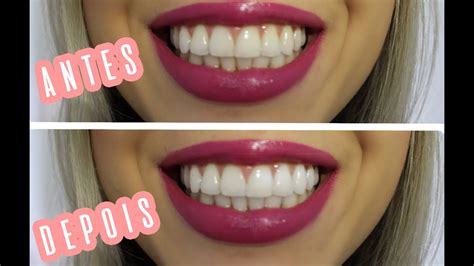 Dica Para Clarear Os Dentes YouTube