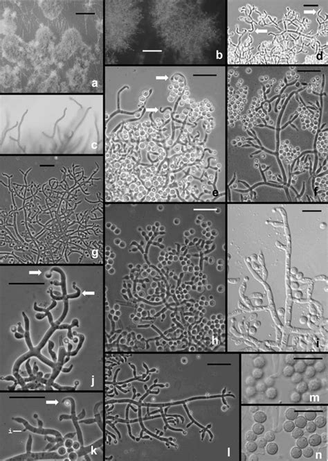 Hypocrea Rufa Trichoderma Viride Anamorph Ab Conidial Pustules