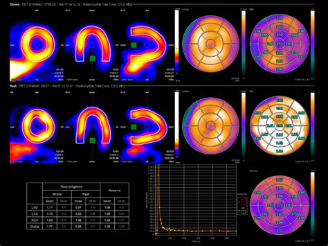 Quantification Of Absolute Flow And Flow Reserve CFR Syngo PET