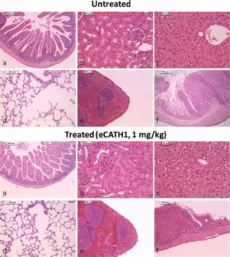 Histopathology Of Organs From Balbc Mice Upon Ecath1 Treatment The