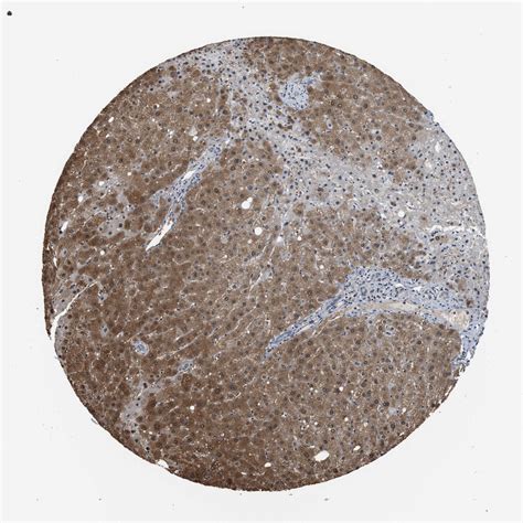 Tissue Expression Of Ldha Staining In Liver The Human Protein Atlas