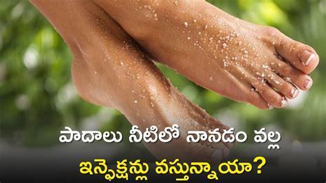 Follow These 5 Tips To Reduce Monsoon Foot Infections In 6 Days