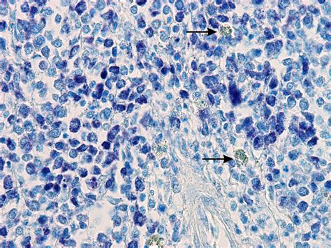 Multiple Cutaneous Mast Cell Tumours In A Boa Imperator Onkels 2020