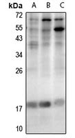 Rabbit Anti Lmo Polyclonal Antibody Absin Univ