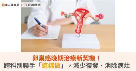 卵巢癌晚期治療新契機！跨科別聯手「這樣做」，減少復發、消除病灶 健康新聞 Pchome Online 新聞