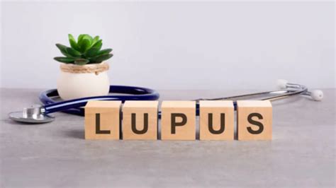 Mengenal Penyakit Lupus Dalam Peringatan Hari Lupus Sedunia Mei