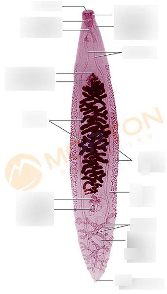 Anatomy of a common liver fluke, Clonorchis sinensis Diagram | Quizlet