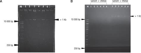 Potential bacteriophages to overcome bacterial infection of Alcaligenes faecalis in diabetic ulcer