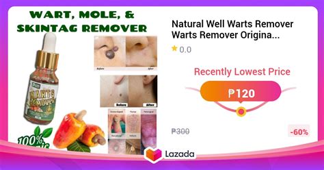 Natural Well Warts Remover Warts Remover Original Mole And Warts