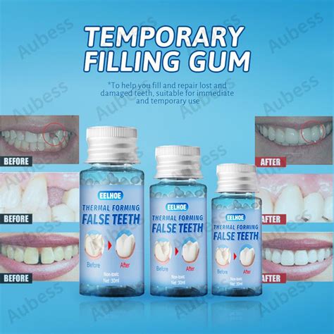 10g20g30g Temporary Tooth Restoration Kit Glue Denture Teeth And Gaps