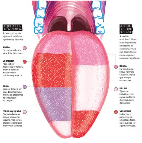 O Que A Língua Pode Revelar Sobre Sua Saúde Veja Saúde