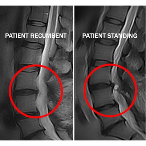 Weight Bearing MRI - Portal Gravity System – Gamma Gurus