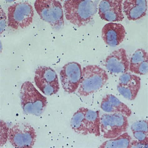 Division of Hematology & Hematologic Malignancies | Internal Medicine ...