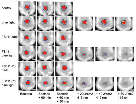 Cimb Free Full Text Cationic Porphyrins As Antimicrobial And