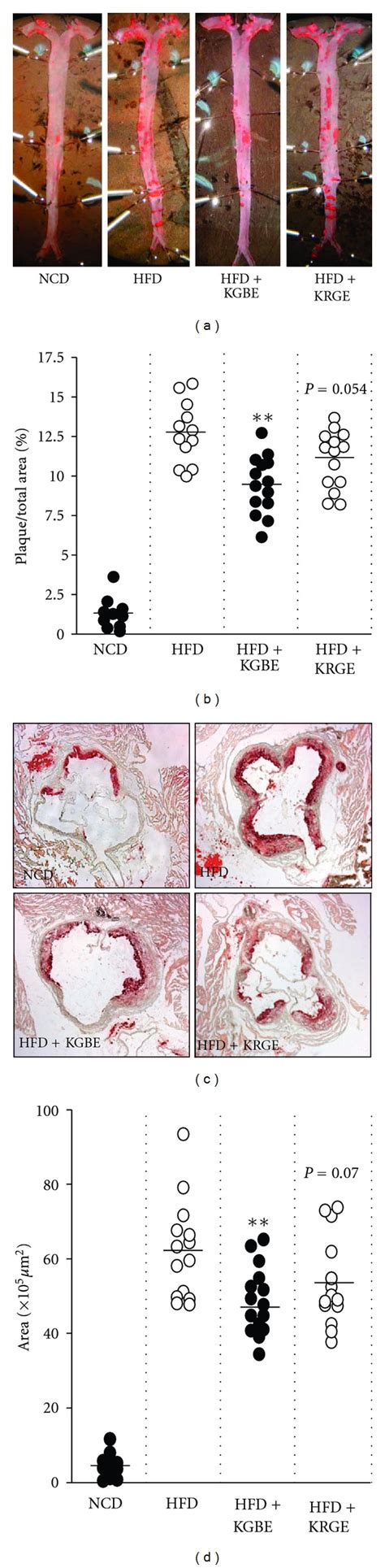 Kgbe Reduces Atherosclerotic Lesion Formation In Apoe Mice Fed A Hfd