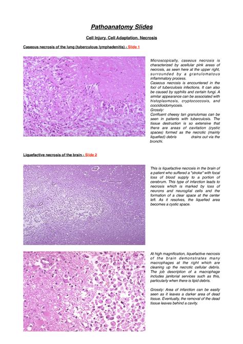 Pathoanatomy slides review - StuDocu