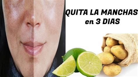 Como Eliminar Las Manchas De La Piel En 3 Minutos Woman To Power Nbkomputer