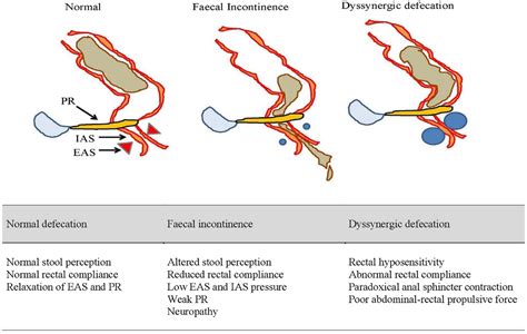 Frontiers Whats New In The Toolbox For Constipation And Fecal