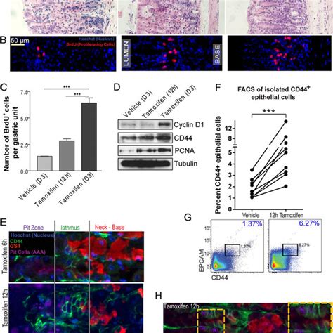 H Pylori Infection Causes Parietal Cell Atrophy And Expansion Of Cd44 Download Scientific