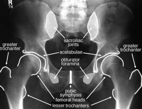 Lower Extremity Radiography Flashcards Quizlet