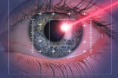 Crean LASER Que Cambia El COLOR De Tus OJOS De Forma PERMANENTE