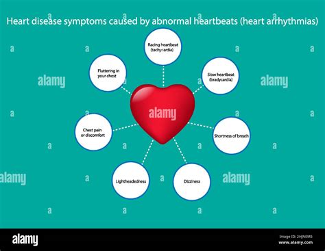 Graphics Drawing Concept Heart Disease Symptoms Caused By Abnormal