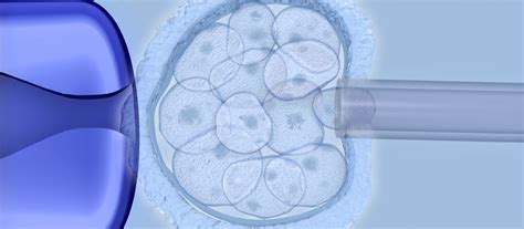 Diagn Stico Gen Tico Pr Implantacional Fert Embryo