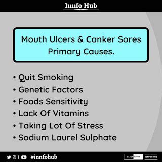 Mouth Ulcer-Treatment & Causes