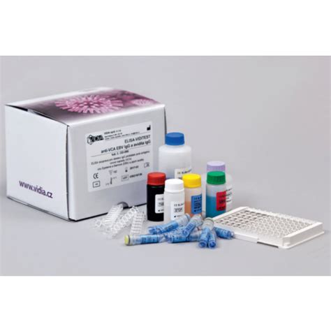 Ebv Assay Kits Anti Ebna Ebv Igm Elisa Kit Tests